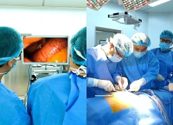 Cụ ông suýt mất mạng vì vô tình nuốt phải hạt mít