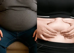 Mỡ nội tạng nguy hiểm hơn mỡ dưới da như thế nào?