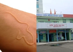 Phát hiện 2 lượt dương tính với giun đầu gai ở Khánh Hòa, bác sĩ cảnh báo nguy cơ từ món ăn khoái khẩu