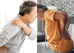 Tuổi nào bắt đầu bị loãng xương và cách phòng bệnh hiệu quả từ sớm