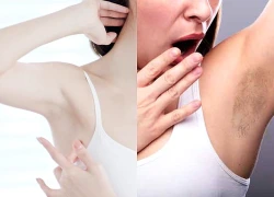 4 nguyên nhân khiến vùng da dưới cánh tay ngày càng thâm sạm, nhiều người mắc phải mà không biết