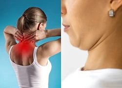 5 bài tập giúp cải thiện độ linh hoạt cột sống cổ