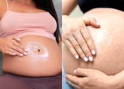 Bác sĩ chỉ 3 cách giúp mẹ bầu giảm nguy cơ rạn da