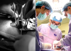 Chỉ nghĩ mình bị ho thông thường, người đàn ông 71 tuổi bất ngờ phát hiện ung thư phổi