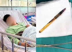 Chiếc bút bi đâm thủng trực tràng bé trai 12 tuổi