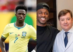 Vinicius gây sốt với diện mạo khác lạ sau phẫu thuật thẩm mỹ