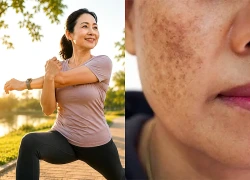 5 dấu hiệu lão hóa đầu tiên không xuất hiện trên da