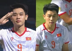 Kiểu tóc mới khiến Đình Bắc thăng hạng nhan sắc