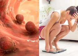 5 dấu hiệu nhận biết sớm ung thư đường tiêu hóa