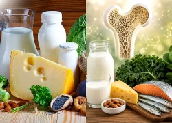 8 cách giúp xương chắc khỏe tự nhiên