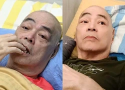 Nam nghệ sĩ bị viện dưỡng lão ngược đãi rơi vào tình trạng nguy hiểm, cơ thể hoại tử không thể cử động