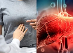 Rối loạn chức năng gan có nguy hiểm không?