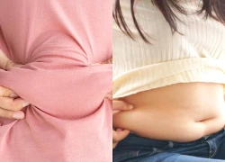 Các loại mỡ tích tụ trong cơ thể, vị trí nào nguy hiểm nhất?