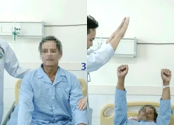 Đột quỵ khi đang làm đồng, bác sĩ khuyên không bỏ lỡ 'giờ vàng'