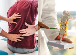 Gai đôi cột sống khi nào cần phẫu thuật?