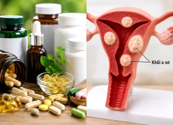Người bệnh u xơ tử cung nên thận trọng với những thực phẩm chức năng nào?