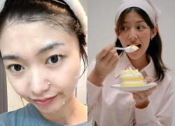 7 thói quen tưởng vô hại nhưng đang âm thầm "bào mòn" collagen, khiến làn da phụ nữ lão hóa "phi mã"