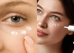 Vì sao chăm mắt mỗi ngày mà quầng thâm, bọng mắt vẫn không hết?