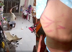 Bé gái 11 tuổi bị người tình của mẹ đánh đập, bắt quỳ xuyên đêm
