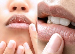 Bỏ ngay 4 thói quen này nếu không muốn đôi môi thâm sạm, bong tróc mỗi ngày