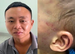 Khởi tố cha dượng tát, bóp cổ con riêng 3 tuổi của vợ