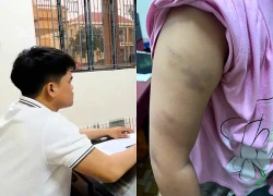 Tạm giữ đối tượng bạo hành con gái của nhân tình ở Đồng Nai