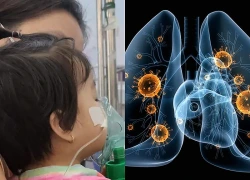 Viêm phổi do Adenovirus ở trẻ: Nhận biết sớm dấu hiệu nguy hiểm