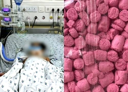 Ăn thịt chuột đồng một tuần, 3 trẻ rối loạn đông máu, một bé phải thở máy