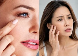 6 dấu hiệu làn da đang già đi nhanh hơn tuổi thật