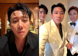 Trấn Thành vừa sửa mũi