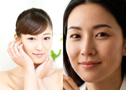 7 thay đổi trên da tưởng bình thường nhưng có thể là tín hiệu lão hóa đang đến sớm