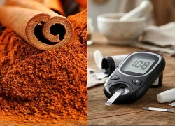 Có nên bổ sung quế để hạ đường huyết?