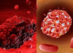 Phát hiện cơ chế mới đằng sau sự hình thành cục máu đông