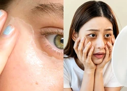 Thức dậy với đôi mắt sưng húp, quầng thâm đậm: 9 cách cải thiện đơn giản cho bạn