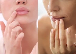 Môi khô, bong tróc và xỉn màu? 4 bước chăm sóc đơn giản giúp đôi môi mềm mịn, hồng hào