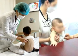 Trẻ sơ sinh trước "cơn bão" mắc virus hợp bào hô hấp nguy hiểm