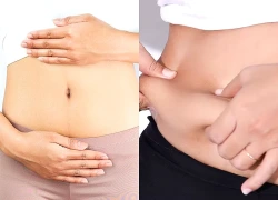 4 thủ phạm khiến bụng dưới ngày càng to và cách cải thiện từ bên trong