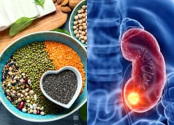 Chuyên gia cảnh báo nguy cơ suy thận nếu tiêu thụ quá nhiều loại dưỡng chất này