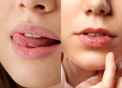 Lý do môi khô, da môi dễ bong vào mùa thu và cách khắc phục