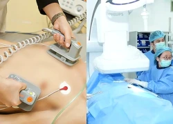 Rối loạn nhịp tim: Cần phát hiện sớm, điều trị đúng