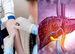Chẩn đoán viêm gan bằng cách nào?