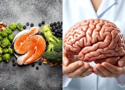 Dinh dưỡng đúng cách bảo vệ não bộ và cải thiện trí nhớ