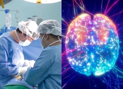 Hy vọng mới cho bệnh nhân Alzheimer nhờ công nghệ 3D