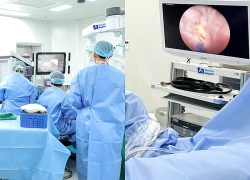 Người phụ nữ tiểu ra máu, đi khám phát hiện chùm khối u chi chít trong bàng quang