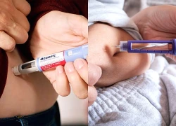 Nguy cơ nhiễm bệnh viêm não hiếm gặp từ các loại thuốc giảm cân thế hệ mới