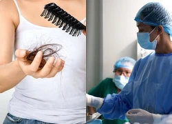 Phát hiện ung thư ở tuổi 34 từ dấu hiệu rụng tóc nhiều