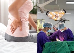 Đau lưng, tê chân kéo dài, người phụ nữ 52 tuổi phát hiện rễ thần kinh bị chèn ép