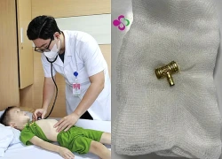 Liên tiếp trẻ nhập viện vì nuốt dị vật