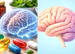 Cẩn trọng với trào lưu tiêm thuốc 'bổ não'