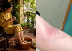 Ngâm chân dưỡng sinh thành rước họa nếu không biết điều này